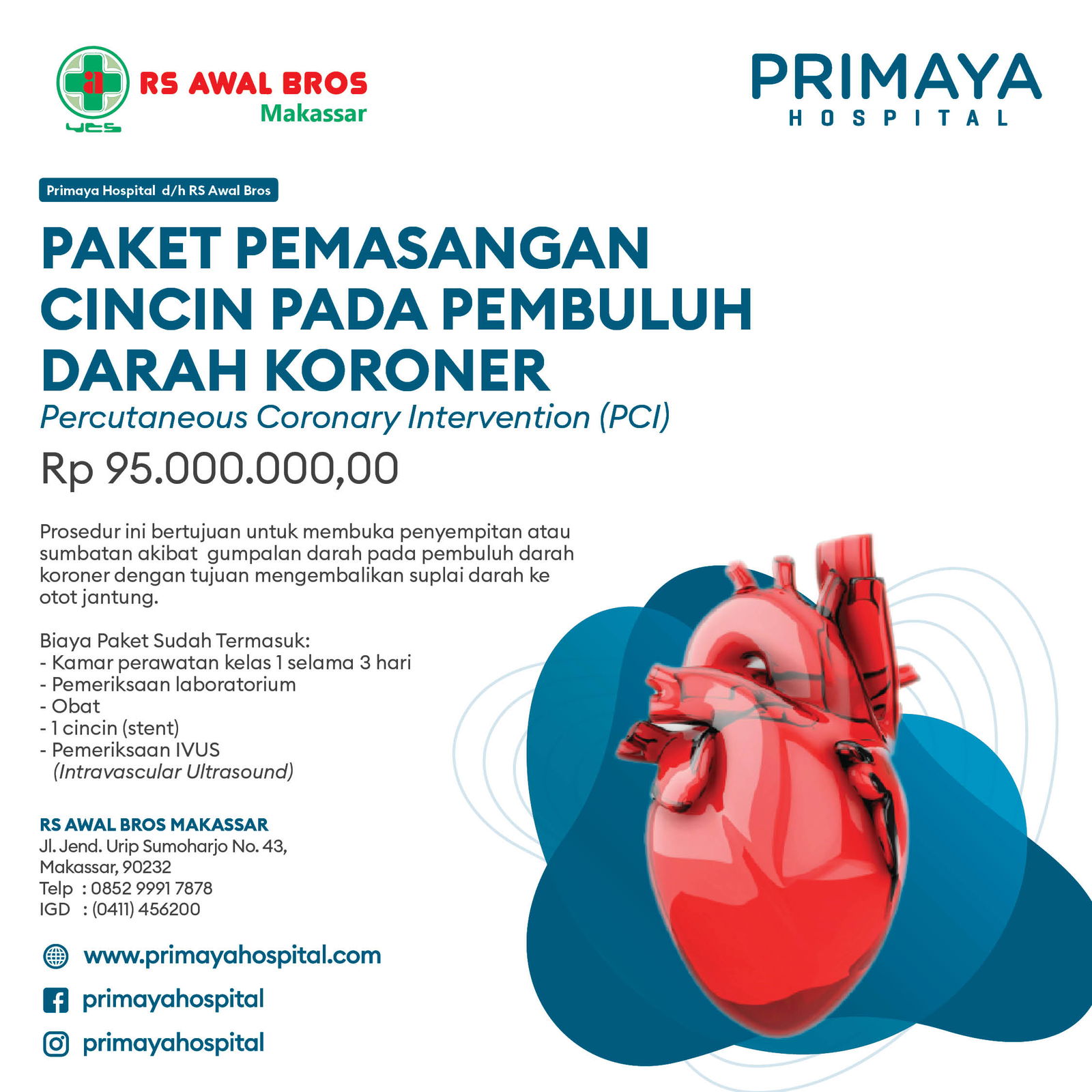 Paket Pemasangan Cincin Pada Pembuluh Darah Koroner