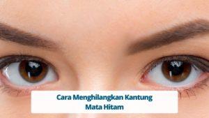 Cara Menghilangkan Kantung Mata Hitam
