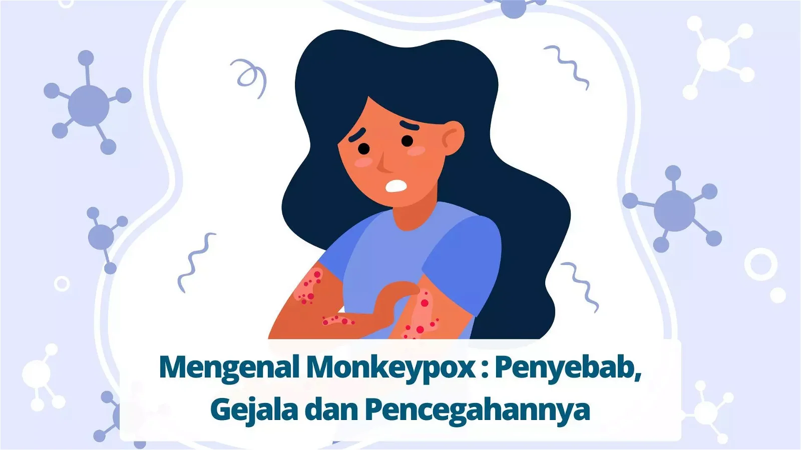 Mengenal Monkeypox Penyebab Gejala Dan Pencegahannya