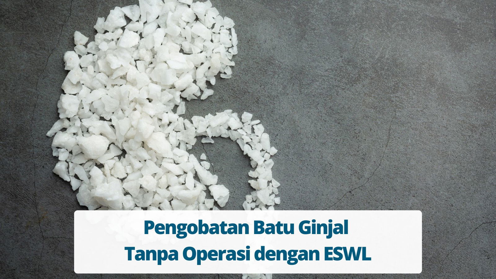 Pengobatan Batu Ginjal Tanpa Operasi Dengan ESWL - Primaya Hospital