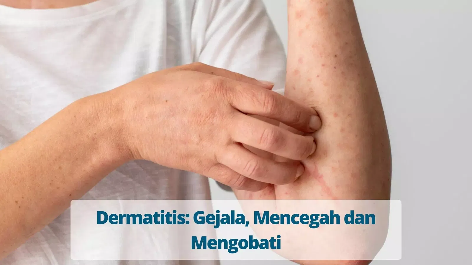 Dermatitis Gejala Mencegah Dan Mengobati Primaya Hospital 7517