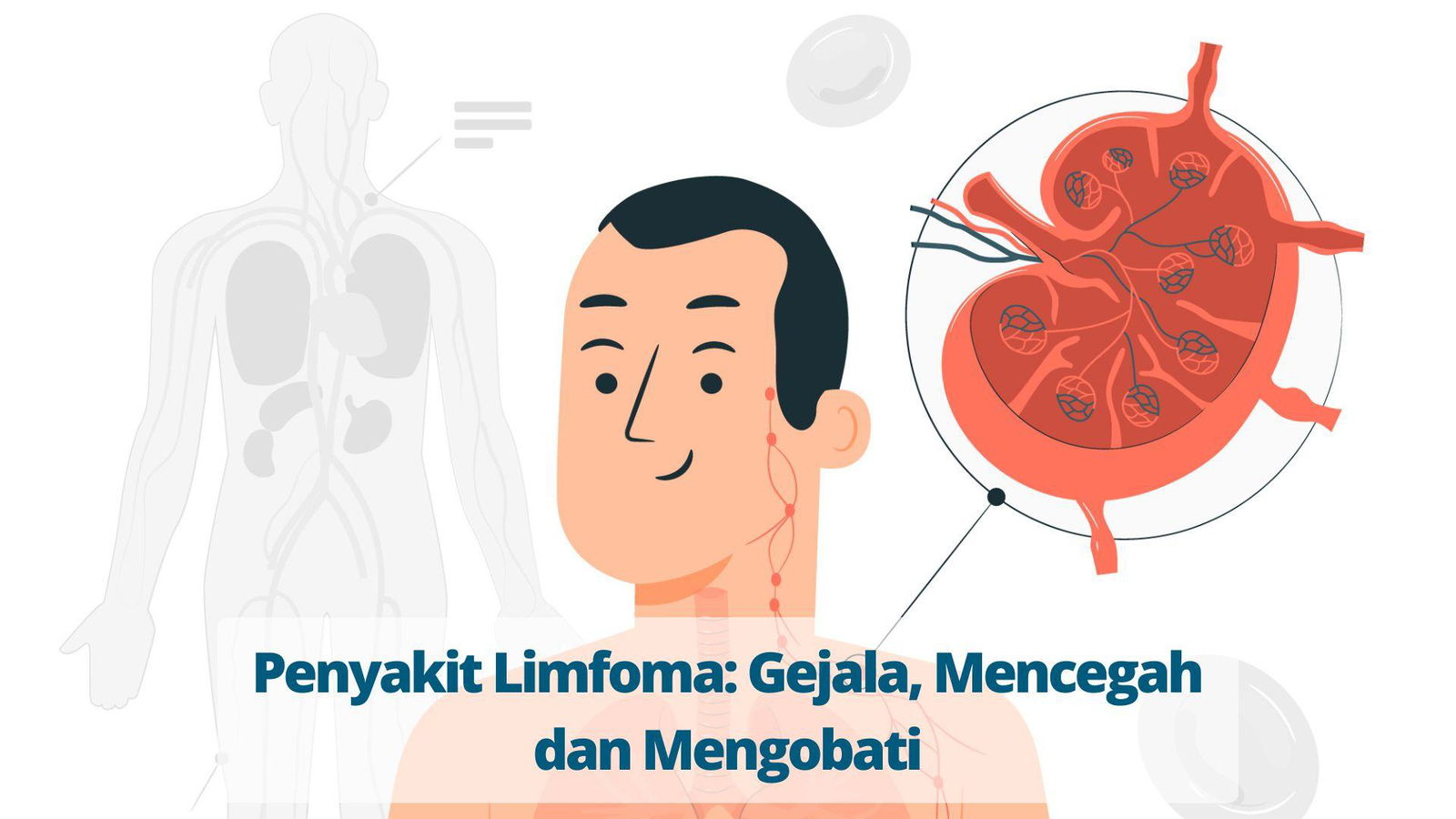 Penyakit Limfoma Gejala Mencegah Dan Mengobati Primaya Hospital 4213