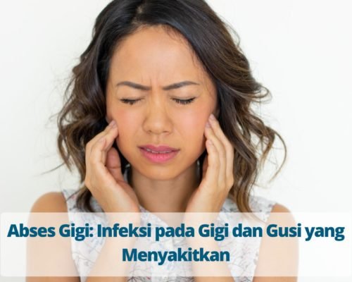 Abses Gigi: Infeksi pada Gigi dan Gusi yang Menyakitkan