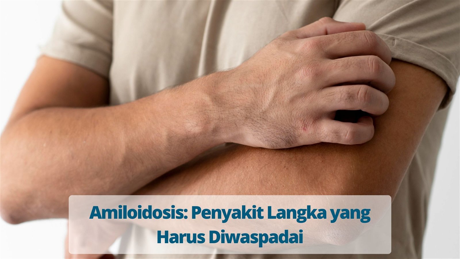 Amiloidosis Penyakit Langka yang Harus Diwaspadai