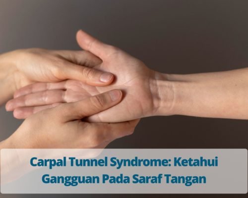 Carpal Tunnel Syndrome: Ketahui Gangguan Pada Saraf Tangan