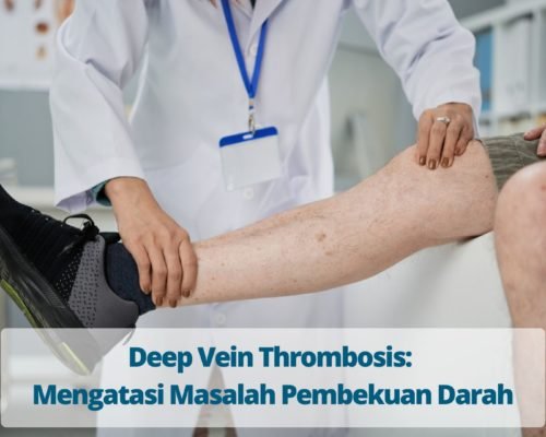 Deep Vein Thrombosis Mengatasi Masalah Pembekuan Darah