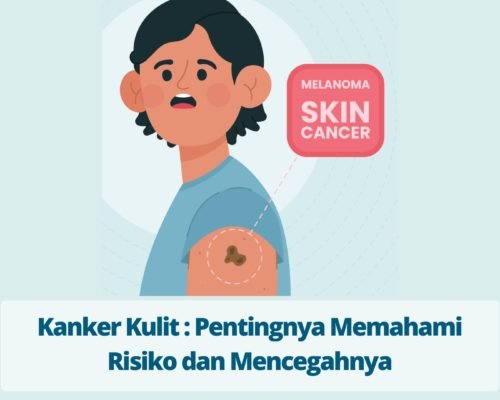 Kanker Kulit Pentingnya Memahami Risiko dan Mencegahnya