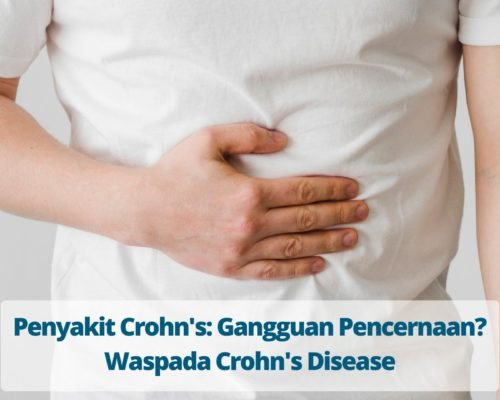 Penyakit Crohn's Gangguan Pencernaan Waspada Crohn's Disease
