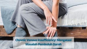 Chronic Venous Insufficiency: Mengatasi Masalah Pembuluh Darah