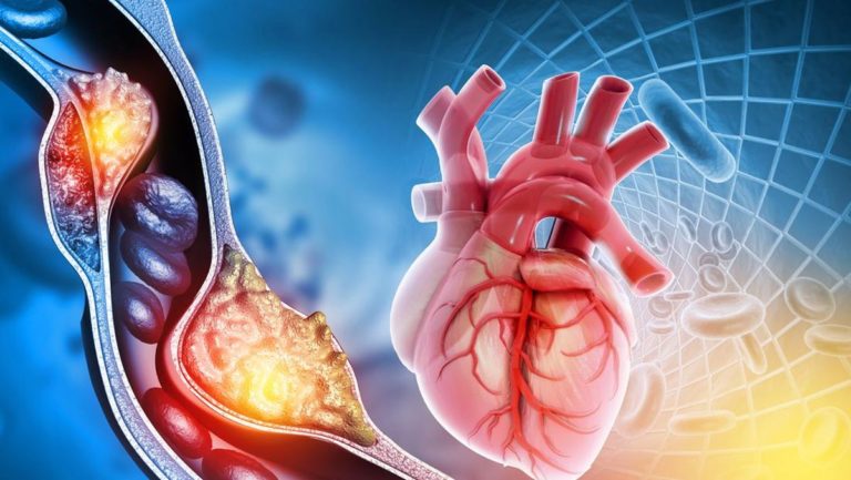 Ciri Ciri Otot Jantung, Struktur, dan Fungsinya yang Patut Dipahami