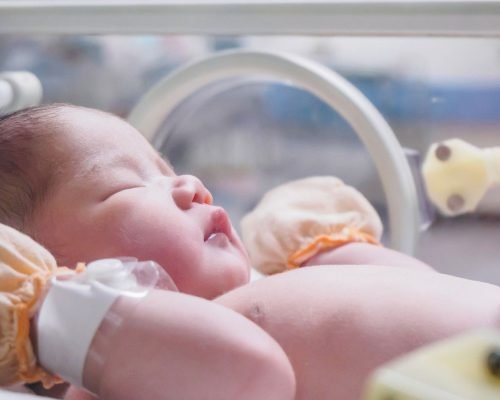Bayi Baru Lahir Tidak Menangis? Waspadai Gejala Asfiksia Neonatorum
