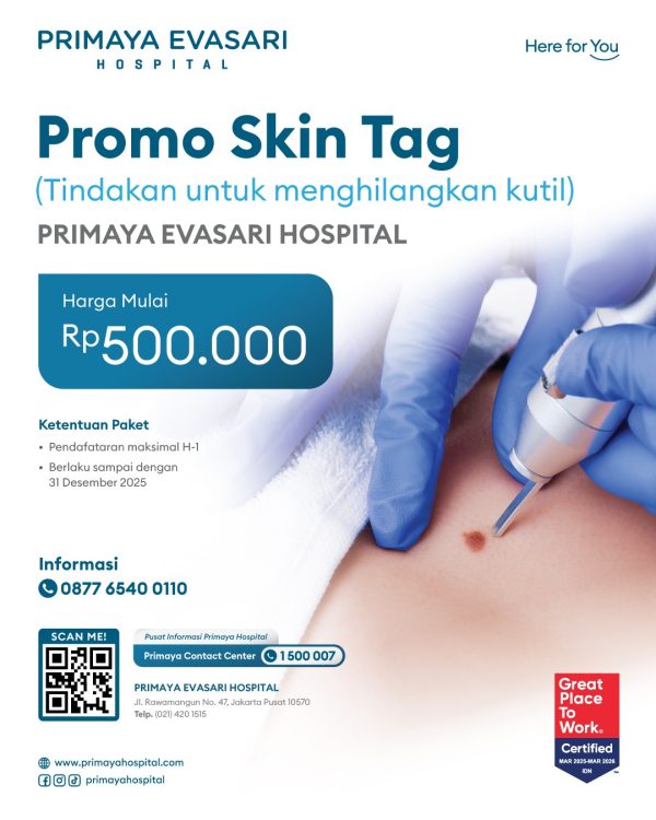 Promo Skin Tag - Evasari Jakarta